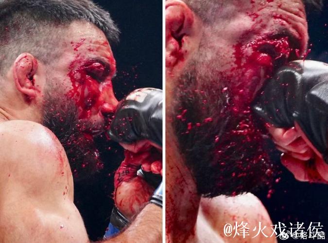 马纳里诺无情出击，瓦林卡满场飞奔疲于应对，四蛋无辜受虐